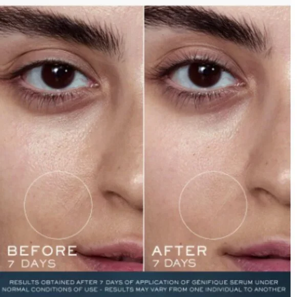 Nwb Lancôme Genifique serum - Picture 2 of 3